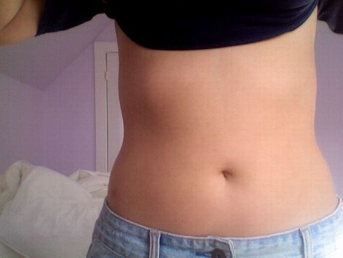 O resultado do tratamento con NEOflorax cápsulas