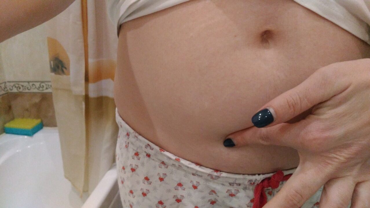 Sinais de infección por helmintos por experiencia persoal