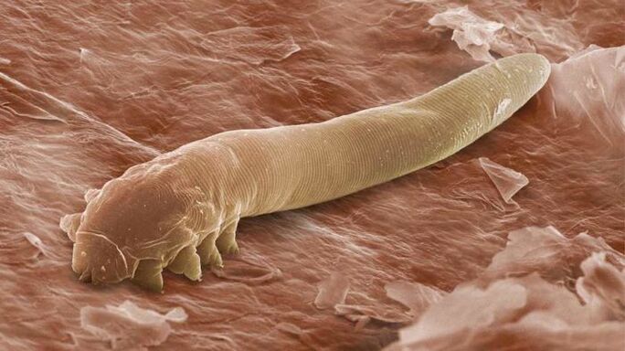Parasito subcutáneo baixo o microscopio