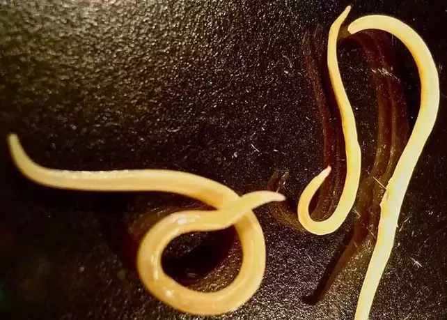 Parasito protozoario do corpo humano